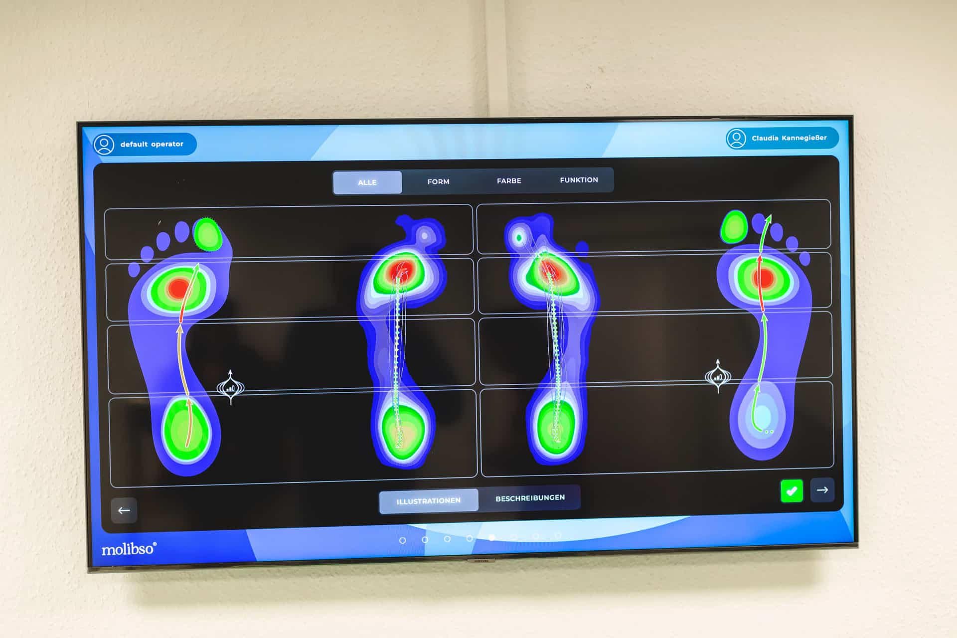 Analyse Druckstellen, Analyse und Diabetesversorgung bei Kannegießer